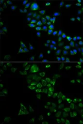 Anti-TRAF3 antibody used in Immunocytochemistry/ Immunofluorescence (ICC/IF). GTX64473