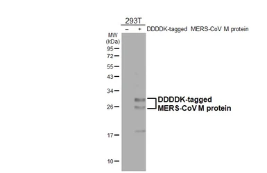 Anti-MERS-CoV M protein antibody [HL4727] used in Western Blot (WB). GTX644731