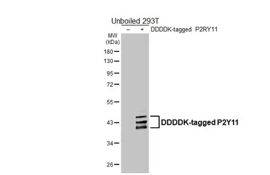 Anti-P2Y11 antibody [HL4748] used in Western Blot (WB). GTX644752