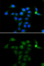 Anti-Tyrosine Aminotransferase antibody used in Immunocytochemistry/ Immunofluorescence (ICC/IF). GTX64477