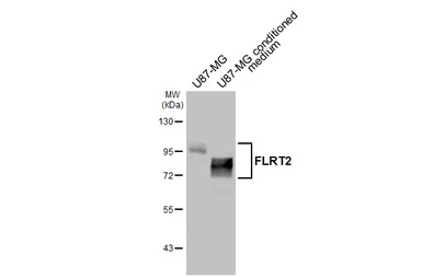 Anti-FLRT2 antibody [HL4784] used in Western Blot (WB). GTX644796