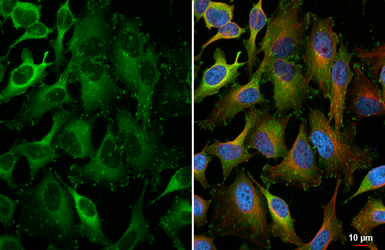 Anti-Paxillin antibody [HL4818] used in Immunocytochemistry/ Immunofluorescence (ICC/IF). GTX644830