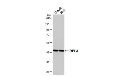 Anti-RPL3 antibody [HL4824] used in Western Blot (WB). GTX644836