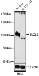 Anti-SUZ12 antibody used in Western Blot (WB). GTX64485