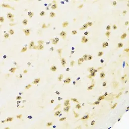Anti-SUZ12 antibody used in IHC (Paraffin sections) (IHC-P). GTX64485