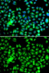 Anti-HSP22 antibody used in Immunocytochemistry/ Immunofluorescence (ICC/IF). GTX64490