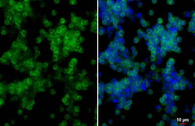 Anti-CCR9 antibody [HL4846] used in Immunocytochemistry/ Immunofluorescence (ICC/IF). GTX644909