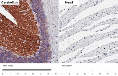 Anti-GABA B Receptor 2 antibody [HL4937] used in IHC (Paraffin sections) (IHC-P). GTX645010