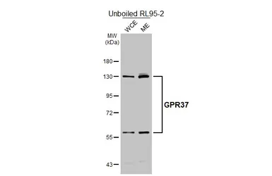 Anti-GPR37 antibody [HL4948] used in Western Blot (WB). GTX645021