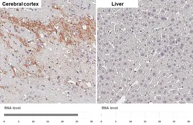 Anti-GluR1 antibody [GT301] used in IHC (Paraffin sections) (IHC-P). GTX645027
