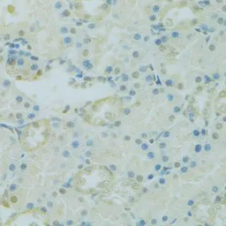 Anti-PHOX2B antibody used in IHC (Paraffin sections) (IHC-P). GTX64506