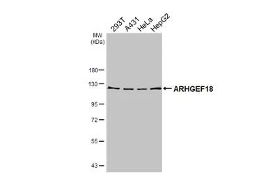 Anti-ARHGEF18 antibody [HL4995] used in Western Blot (WB). GTX645088