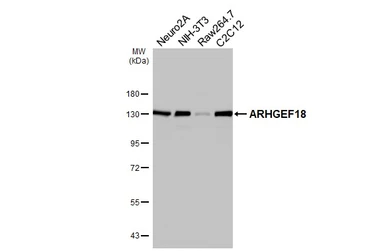 Anti-ARHGEF18 antibody [HL4995] used in Western Blot (WB). GTX645088