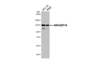 Anti-ARHGEF18 antibody [HL4995] used in Western Blot (WB). GTX645088