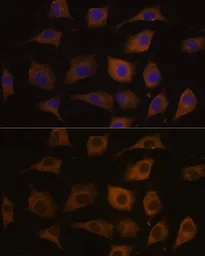 Anti-AChR alpha 7 antibody used in Immunocytochemistry/ Immunofluorescence (ICC/IF). GTX64511