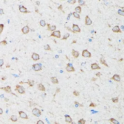 Anti-CYLD antibody used in IHC (Paraffin sections) (IHC-P). GTX64513