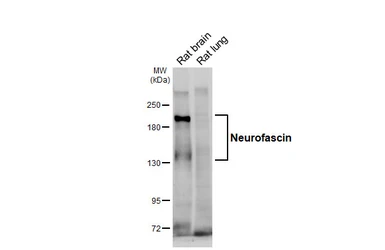 Anti-Neurofascin antibody [GT316] used in Western Blot (WB). GTX645191