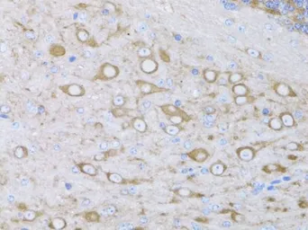 Anti-MYH10 antibody used in IHC (Paraffin sections) (IHC-P). GTX64520