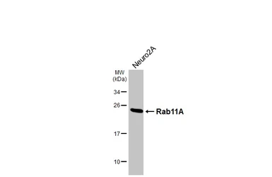 Anti-Rab11A antibody [HL5043] used in Western Blot (WB). GTX645213