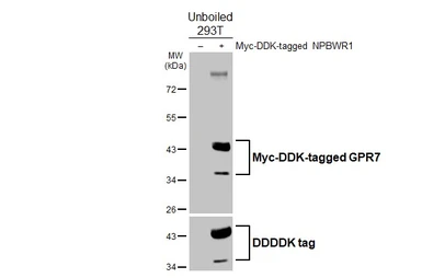 Anti-GPR7 antibody [HL5047] used in Western Blot (WB). GTX645217
