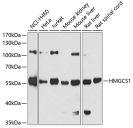 Anti-HMGCS1 antibody used in Western Blot (WB). GTX64522