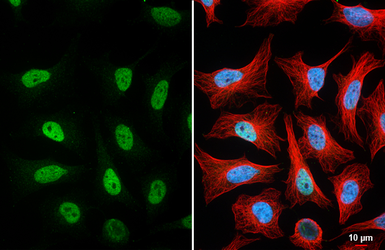 Anti-MSH6 antibody [HL5070] used in Immunocytochemistry/ Immunofluorescence (ICC/IF). GTX645260