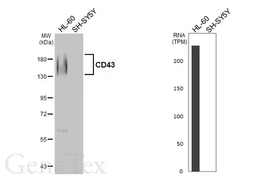 Anti-CD43 antibody [HL5086] used in Western Blot (WB). GTX645276