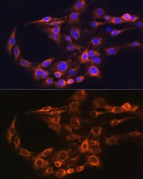 Anti-FCGRT antibody used in Immunocytochemistry/ Immunofluorescence (ICC/IF). GTX64528
