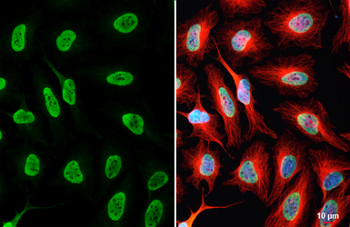 Anti-HNRNPA3 antibody [HL5092] used in Immunocytochemistry/ Immunofluorescence (ICC/IF). GTX645282