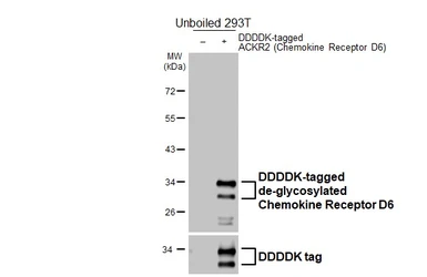 Anti-Chemokine Receptor D6 antibody [HL5104] used in Western Blot (WB). GTX645298