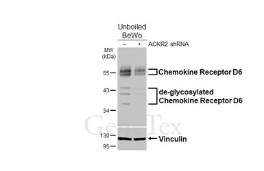 Anti-Chemokine Receptor D6 antibody [HL5104] used in Western Blot (WB). GTX645298