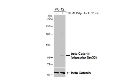 Anti-beta Catenin (phospho Ser33) antibody [HL5105] used in Western Blot (WB). GTX645299