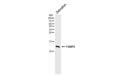 Anti-FABP2 antibody [HL5114] used in Western Blot (WB). GTX645308