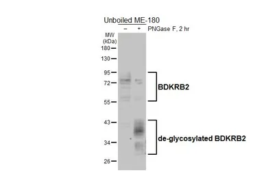 Anti-BDKRB2 antibody [HL5131] used in Western Blot (WB). GTX645327