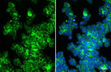 Anti-c-Kit antibody [HL5146] used in Immunocytochemistry/ Immunofluorescence (ICC/IF). GTX645342