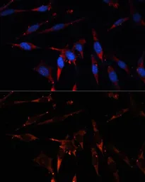 Anti-CPT1B antibody used in Immunocytochemistry/ Immunofluorescence (ICC/IF). GTX64535