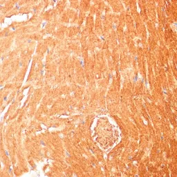 Anti-CPT1B antibody used in IHC (Paraffin sections) (IHC-P). GTX64535