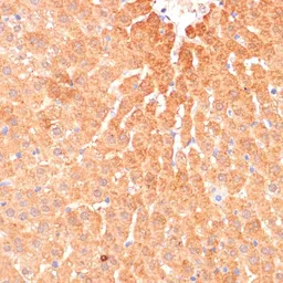 Anti-CPT1B antibody used in IHC (Paraffin sections) (IHC-P). GTX64535