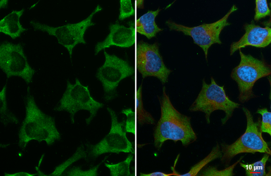 Anti-FXR1 antibody [HL5155] used in Immunocytochemistry/ Immunofluorescence (ICC/IF). GTX645351