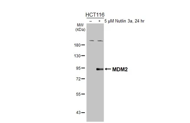 Anti-MDM2 antibody [HL5171] used in Western Blot (WB). GTX645423