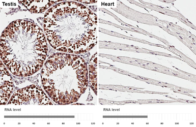 Anti-PCBP2 antibody [HL5177] used in IHC (Paraffin sections) (IHC-P). GTX645429