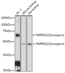 Anti-TMPRSS2 antibody used in Western Blot (WB). GTX64544