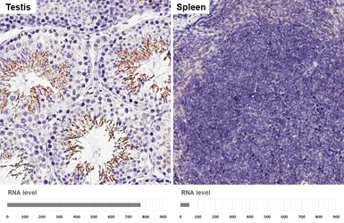 Anti-GPX4 antibody [HL5228] used in IHC (Paraffin sections) (IHC-P). GTX645484