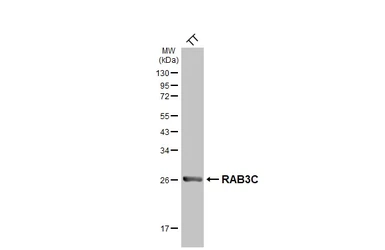 Anti-RAB3C antibody [HL5239] used in Western Blot (WB). GTX645495