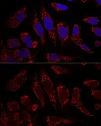 Anti-CHCHD3 antibody used in Immunocytochemistry/ Immunofluorescence (ICC/IF). GTX64550