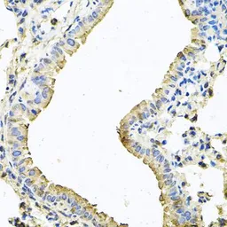 Anti-CHCHD3 antibody used in IHC (Paraffin sections) (IHC-P). GTX64550