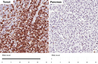 Anti-CD5 antibody [HL5244] used in IHC (Paraffin sections) (IHC-P). GTX645500