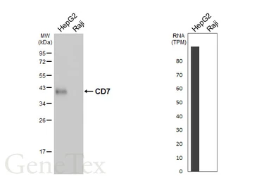 Anti-CD7 antibody [HL5248] used in Western Blot (WB). GTX645504