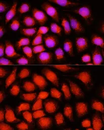 Anti-ACADVL antibody used in Immunocytochemistry/ Immunofluorescence (ICC/IF). GTX64566