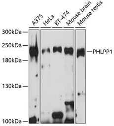 Anti-PHLPP1 antibody used in Western Blot (WB). GTX64568